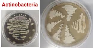 Actinobacteria- An Overview