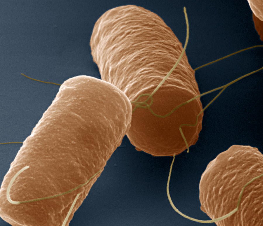 bacillus cereus 