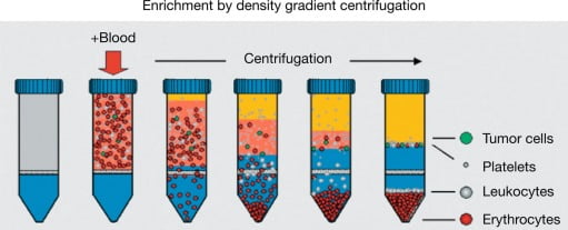 density-type of gradient