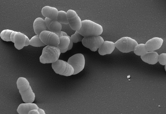 Actinobacteria-An Overview