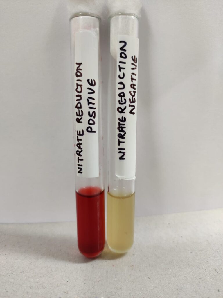 Biochemical Test of Kingella kingae