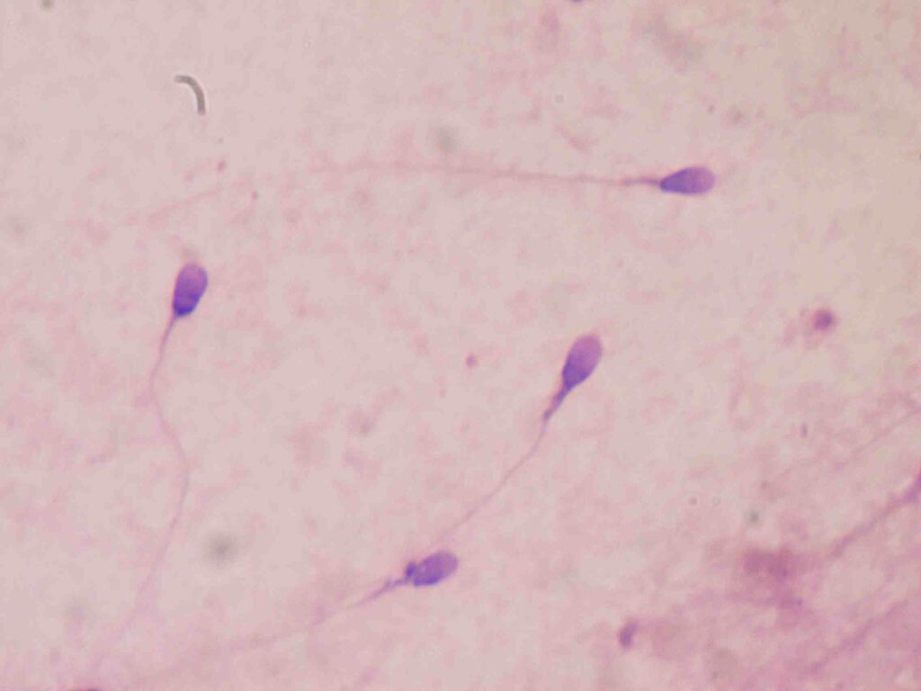 Semen analysis and bull fertility