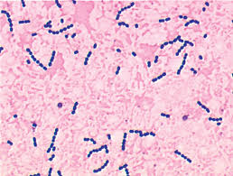 Biochemical Test of Streptococcus agalactiae