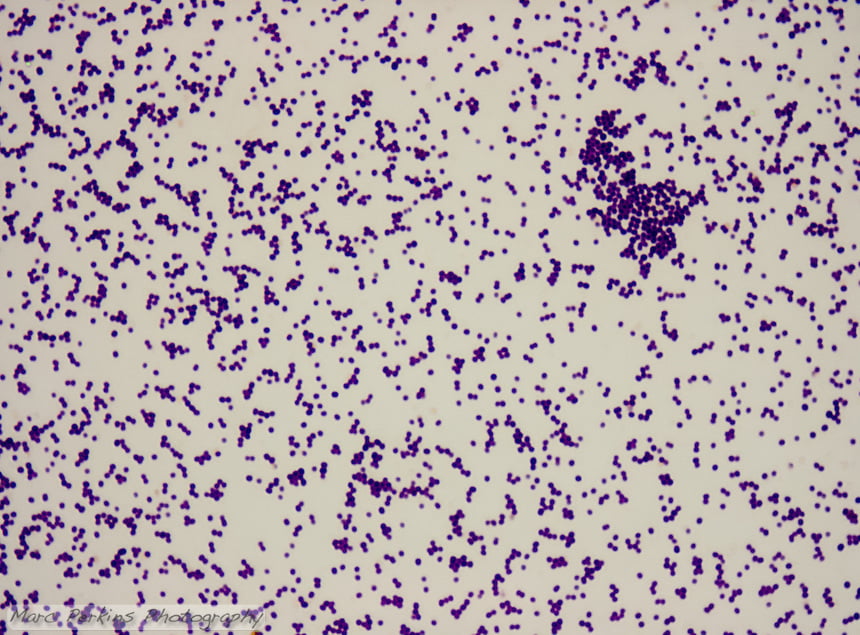 staphylococcus-epidermidis