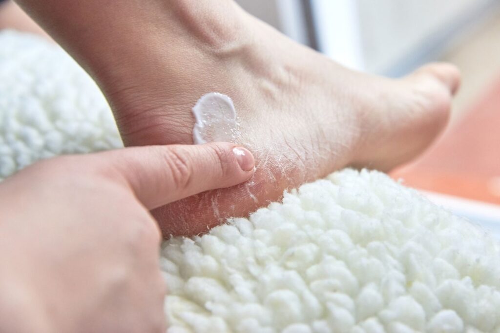 Antifungal creams, ointments, or sprays for the skin
