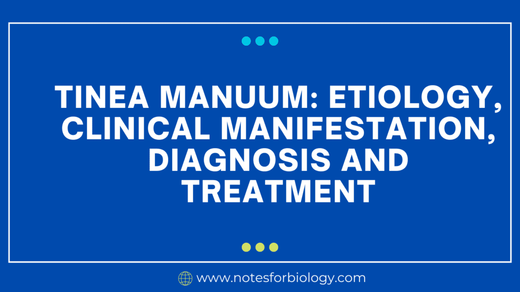 Tinea manuum etiology, clinical manifestation, diagnosis and treatment