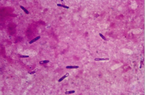 Clostridium novyi