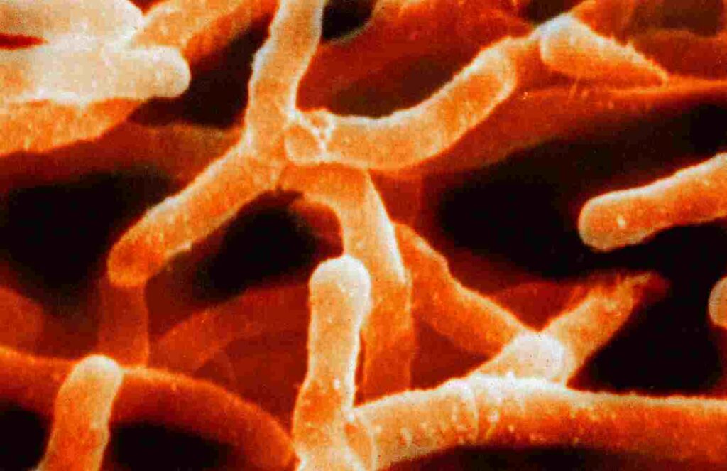 Actinomyces Species