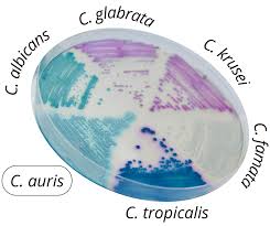 CHROMagar- Composition, Principle, Preparation, Results, Uses