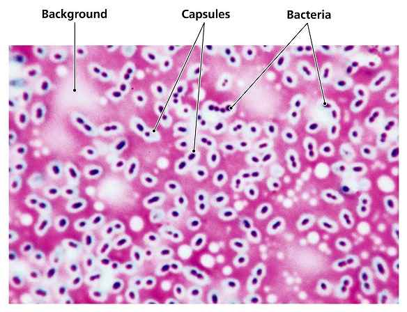 Capsule Stain