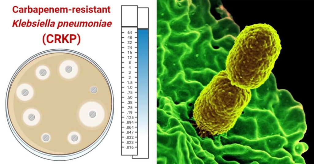 Carbapenem-Resistant Klebsiella pneumoniae