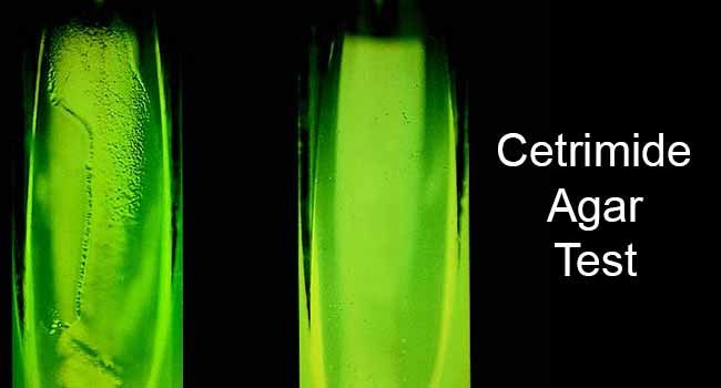 Cetrimide Agar Test