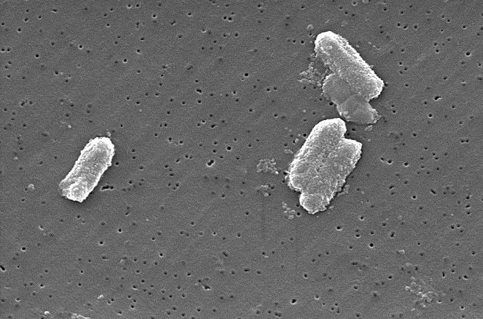 Citrobacter spp.