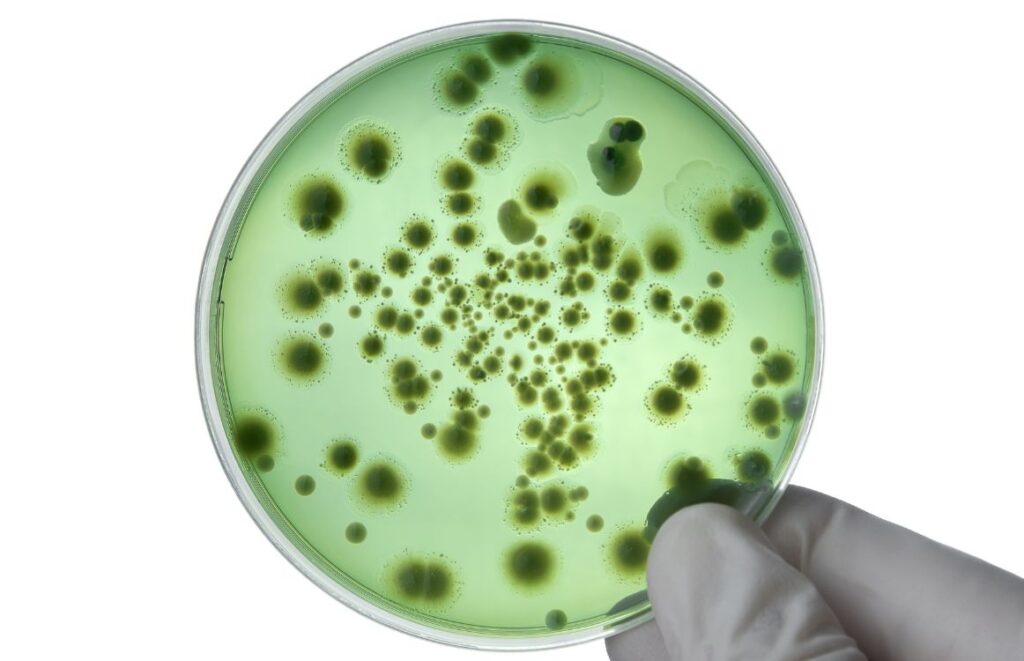 Colony Forming Units (CFUs)