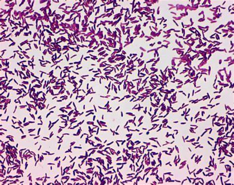 Corynebacterium diphtheriae