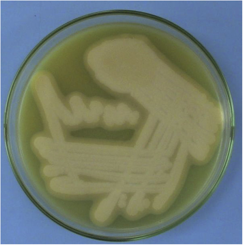 Egg Yolk Agar