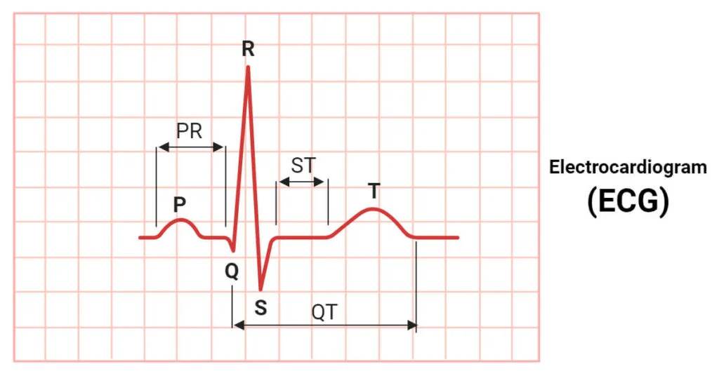 Electrocardiogram (ECG)