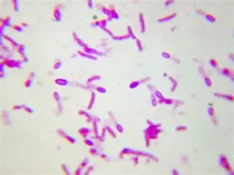 Endospore Staining