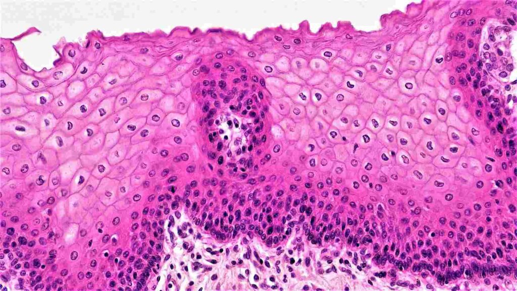 Epithelial and Connective Tissue