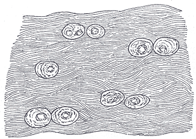 Fibrocartilage