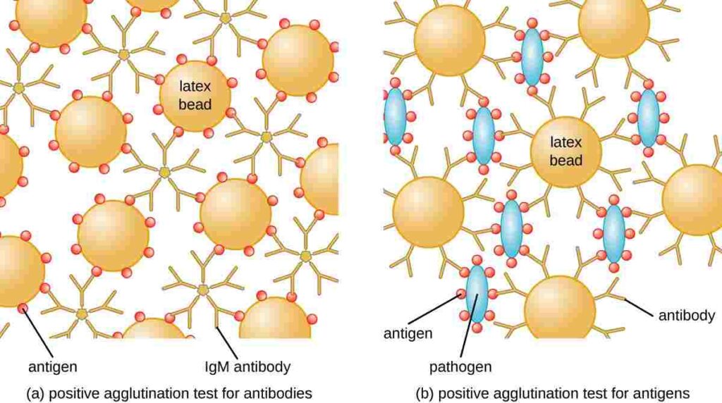 Latex Agglutination Test