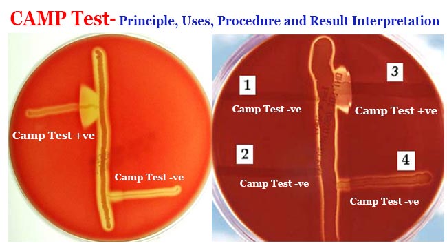 CAMP Test