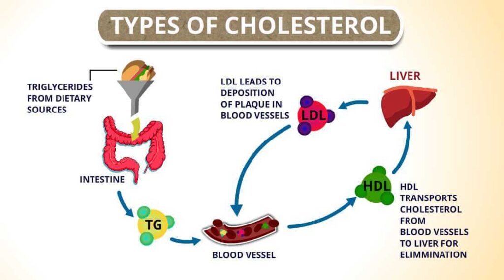 Types-of-cholesterol