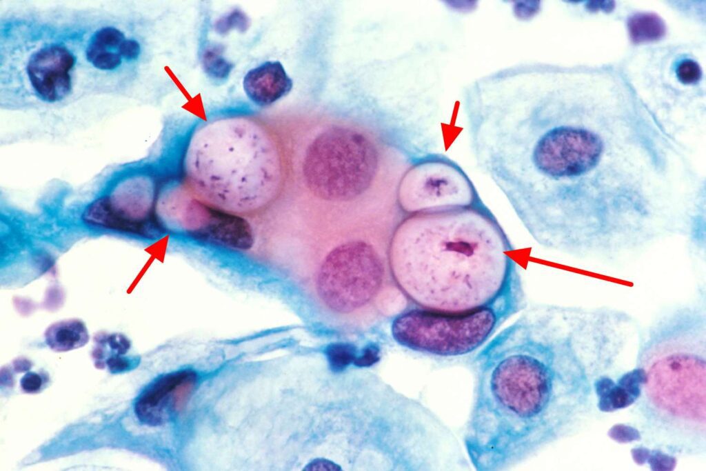Chlamydia trachomatis