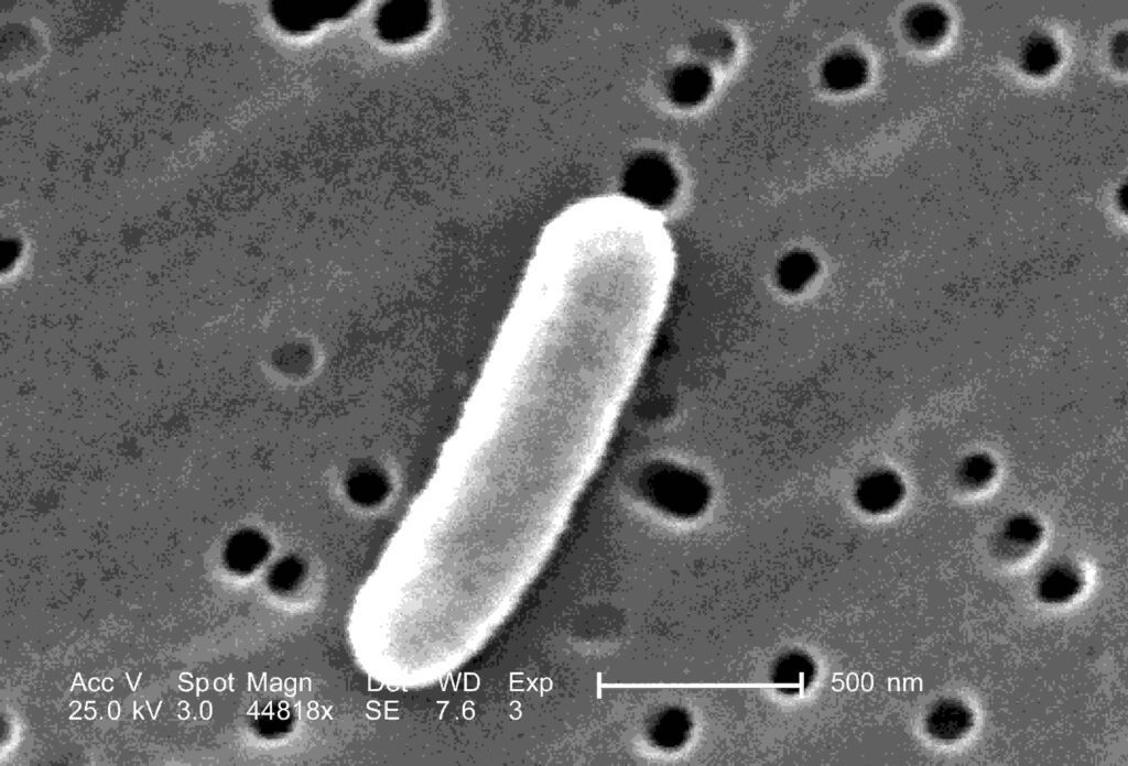 Enterotoxigenic E. coli (ETEC)